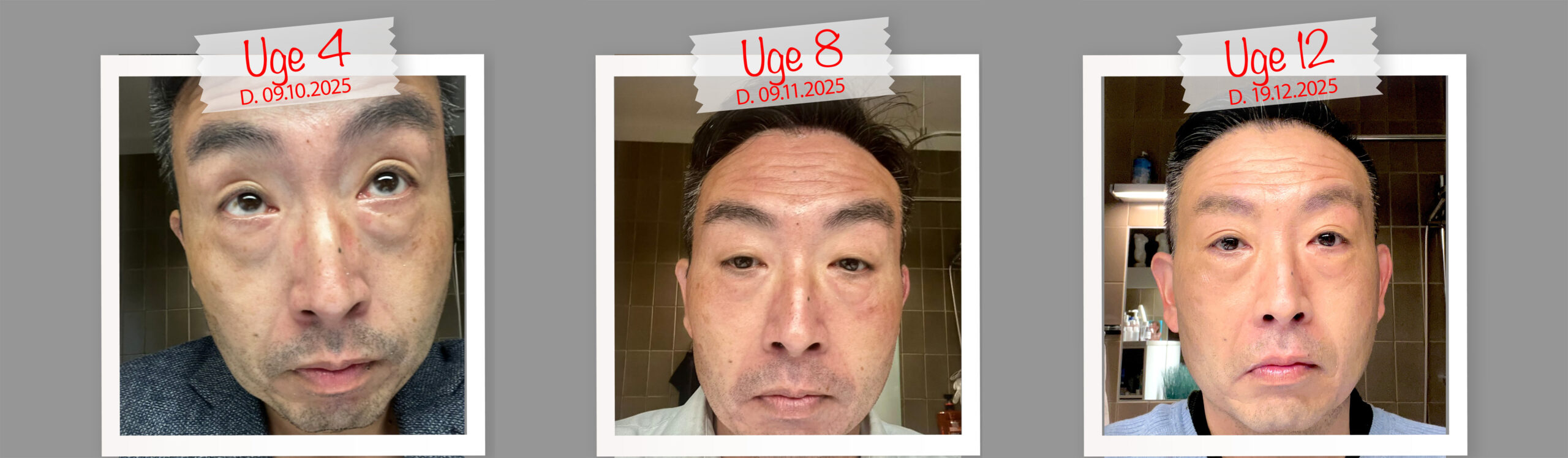 Anmeldelse af Pure & Care – dokumenteret anti-age program testet over 12 uger